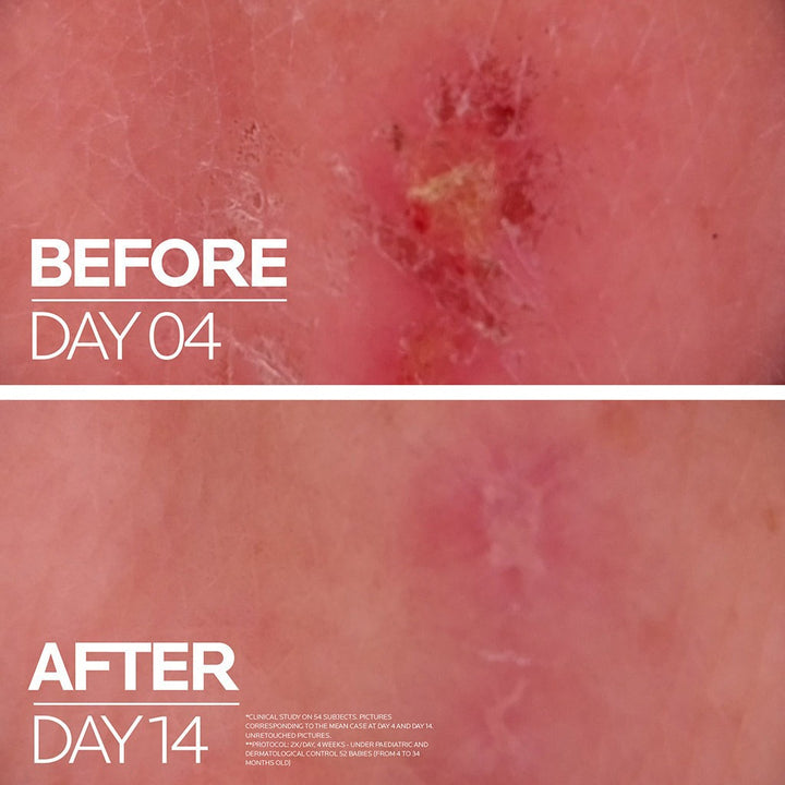 La Roche Posay Cicaplast Baume B5+ Ultra Repairing Soothing Balm 40ml - Easy Pharmacy LLC