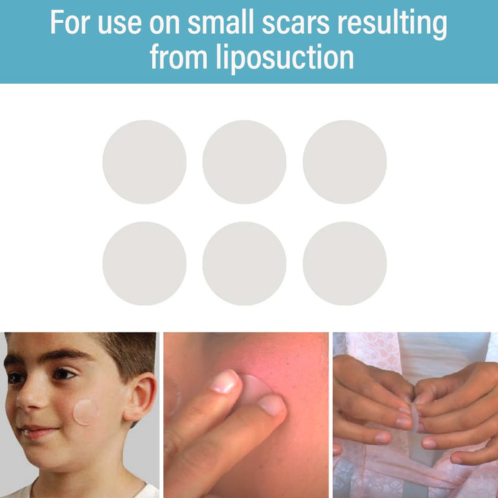 NewGel+ Advanced Medical-Grade Silicone Gel Dots, NG-380 Clear, Pack of 6's - Easy Pharmacy LLC