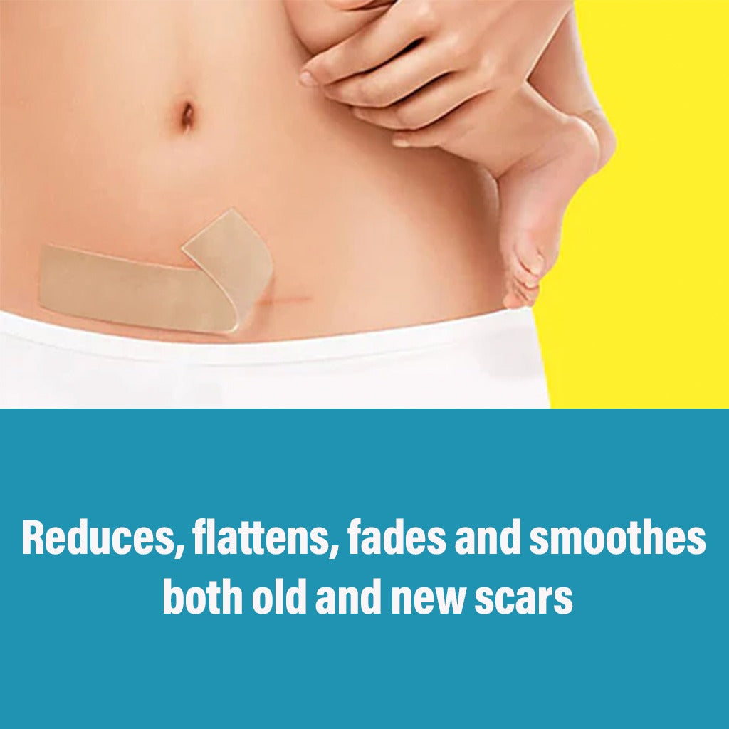 NewGel+ Advanced Medical-Grade 2" x 8" C-Section Strip For C-Section Scar Management, NG-160 Beige, Pack of 1's - Easy Pharmacy LLC