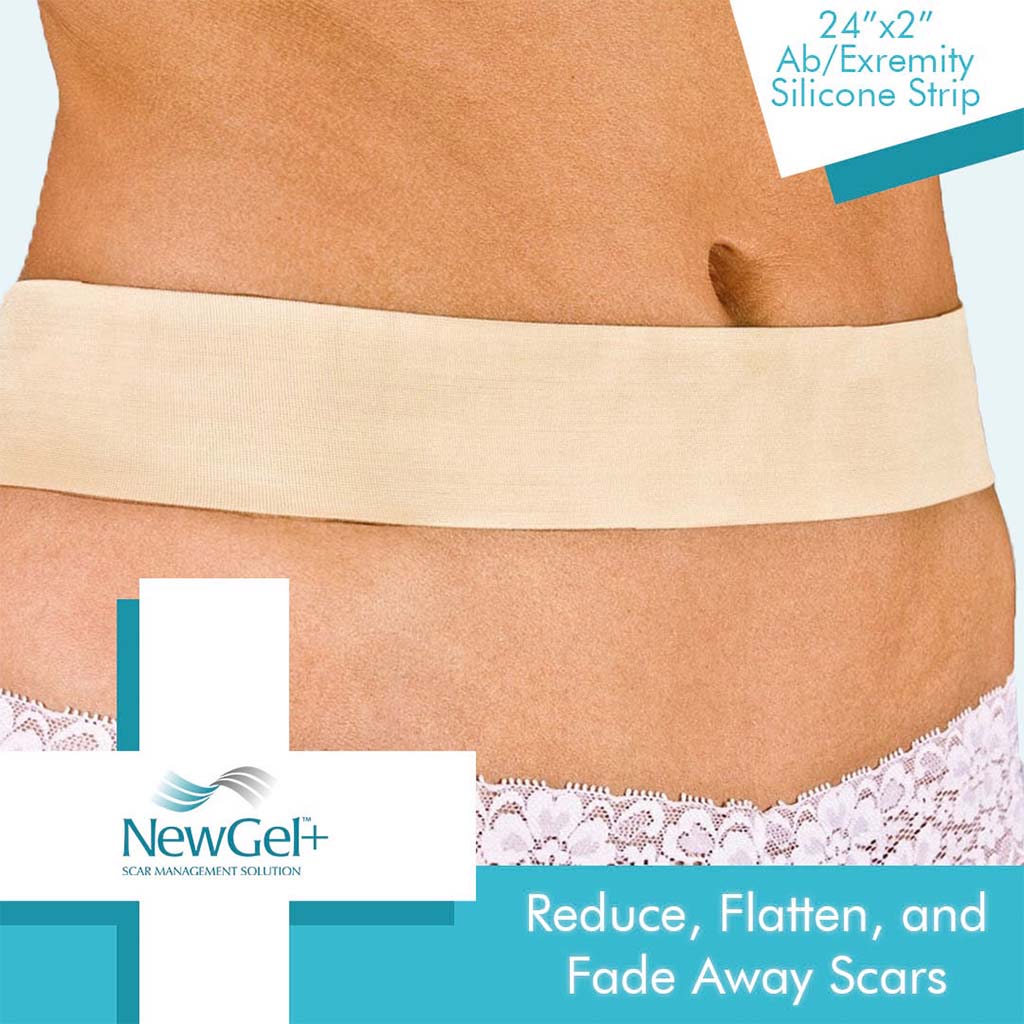NewGel+ 24" x 2" Abdomen/Extremity Silicone Strip, Beige NG-164, Pack of 1's - Easy Pharmacy LLC