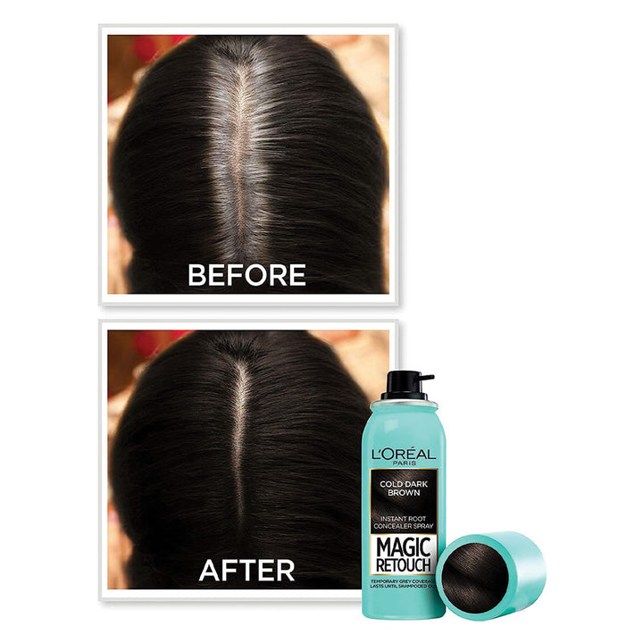 Loreal Paris Magic Retouch Instant Root Concealer Spray Cold Dark Brown - Easy Pharmacy LLC