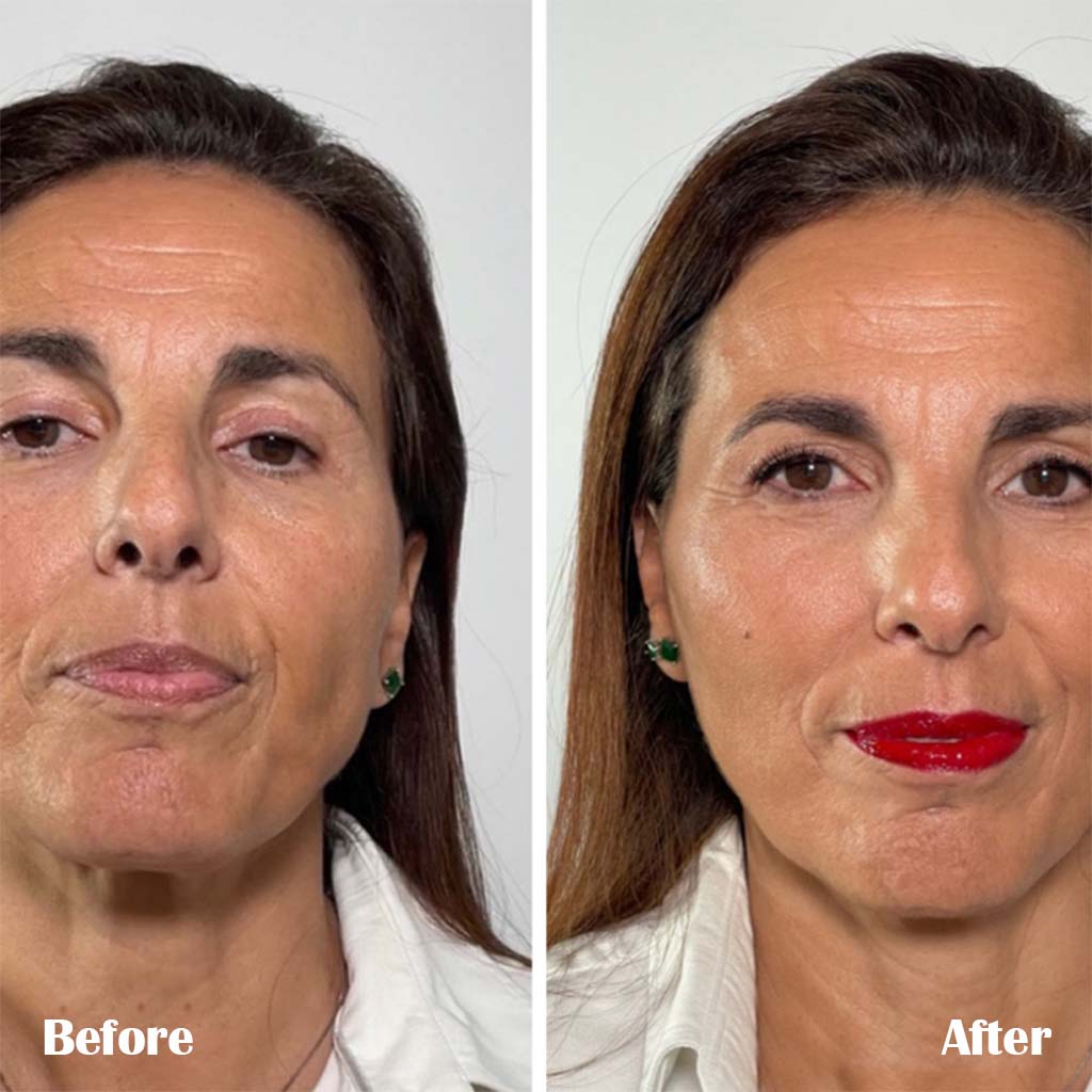 LaCabine 24K Gold Flash 2ml Golden Facial Serum Ampoules For Instant Glowing Skin, Limited Edition, Pack of 1's - Easy Pharmacy LLC