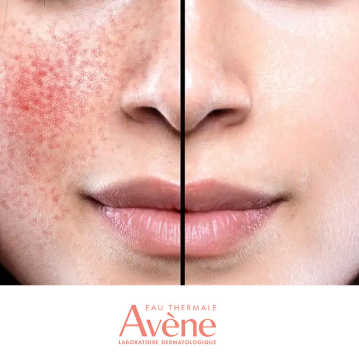 Avene Antirougeurs Jour Mositurizing Protecting Emulsion For Normal to Combination, Sensitive Skin 40ml - Easy Pharmacy LLC
