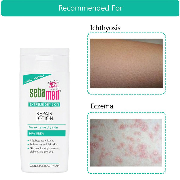 Sebamed Extreme Dry Urea Lotion 200 mL - Easy Pharmacy LLC