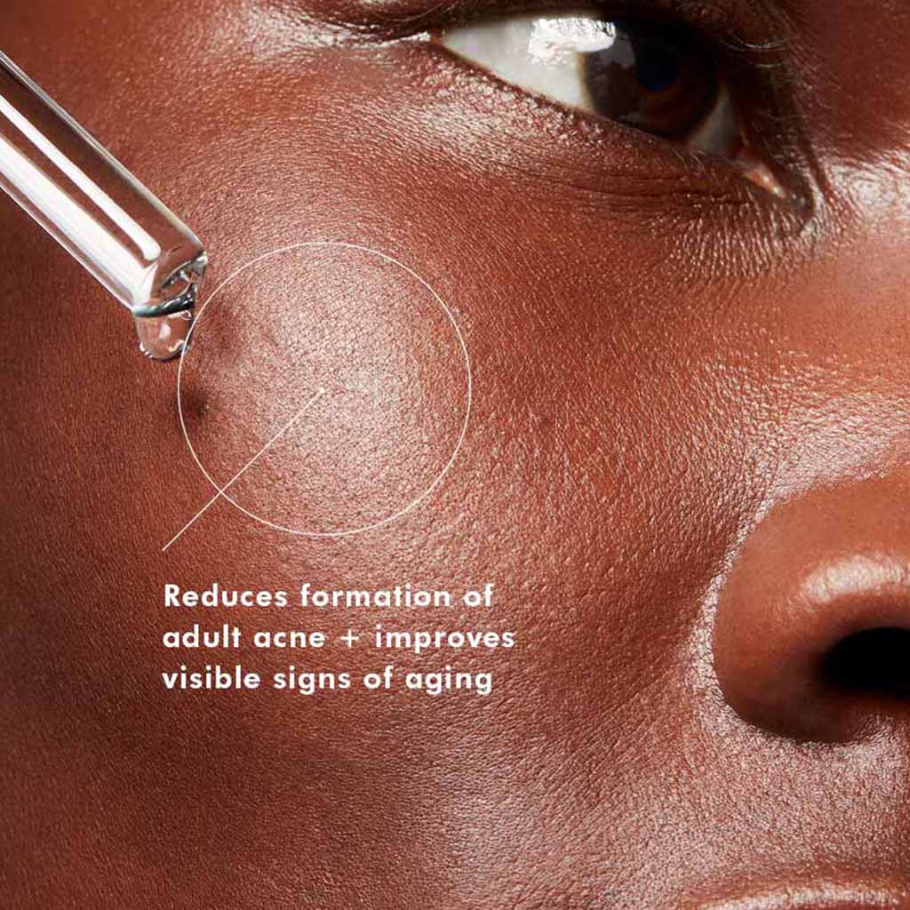 Skinceuticals Blemish + Age Defense Facial Serum With Salicylic Acid & Glycolic Acid 30ml - Easy Pharmacy LLC