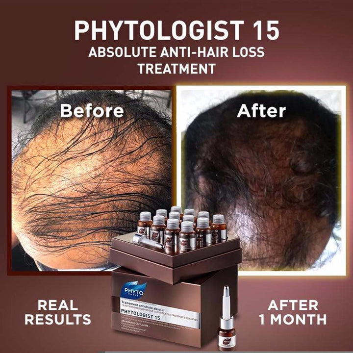 Phyto Phytologist 15 Hair Loss Treatment 3.5ml Ampoules, Pack of 12's - Easy Pharmacy LLC