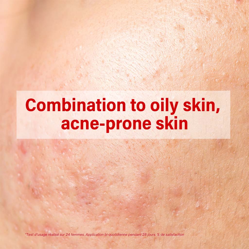 ACM Sebionex Trio Anti-Imperfection Soothing Cream For Oily And Acne-Prone Skin 40ml - Easy Pharmacy LLC
