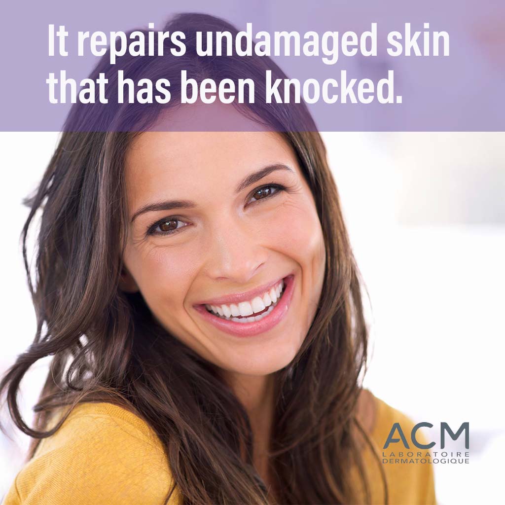 ACM Cicastim A Soothing Cream For Bruises & Contusions 20ml - Easy Pharmacy LLC