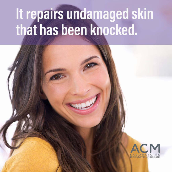 ACM Cicastim A Soothing Cream For Bruises & Contusions 20ml - Easy Pharmacy LLC