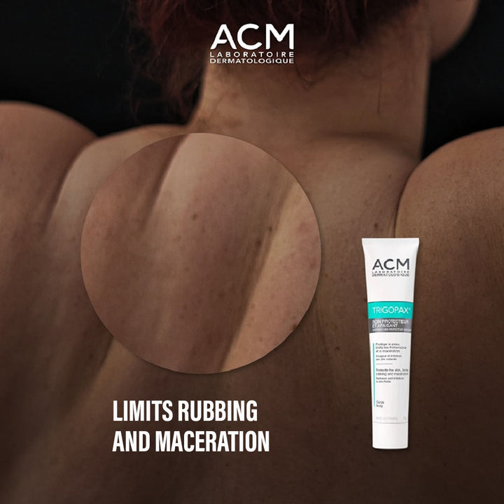 ACM Trigopax Cream 75 g - Easy Pharmacy LLC