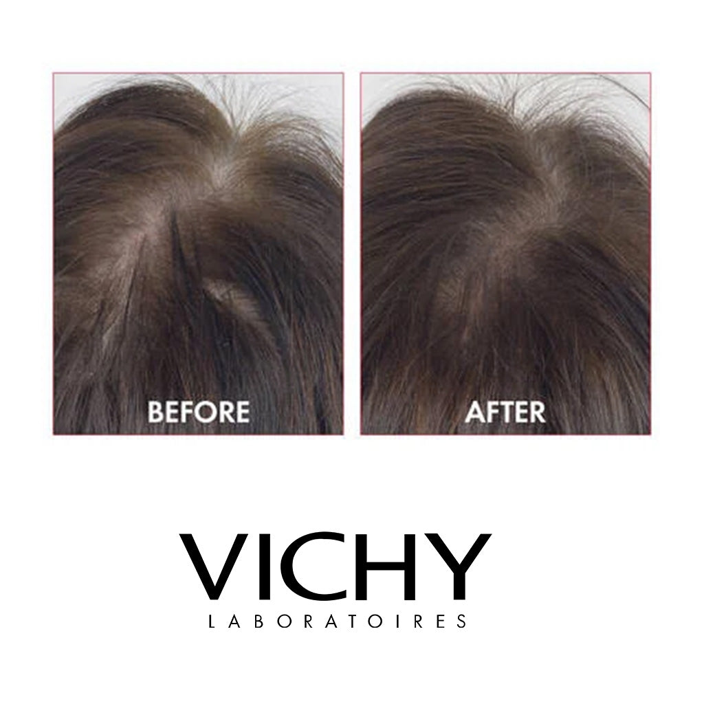Vichy Dercos Aminexil Clinical 5 Anti-Hair Fall Treatment For Men, Pack of 6ml x 21's - Easy Pharmacy LLC