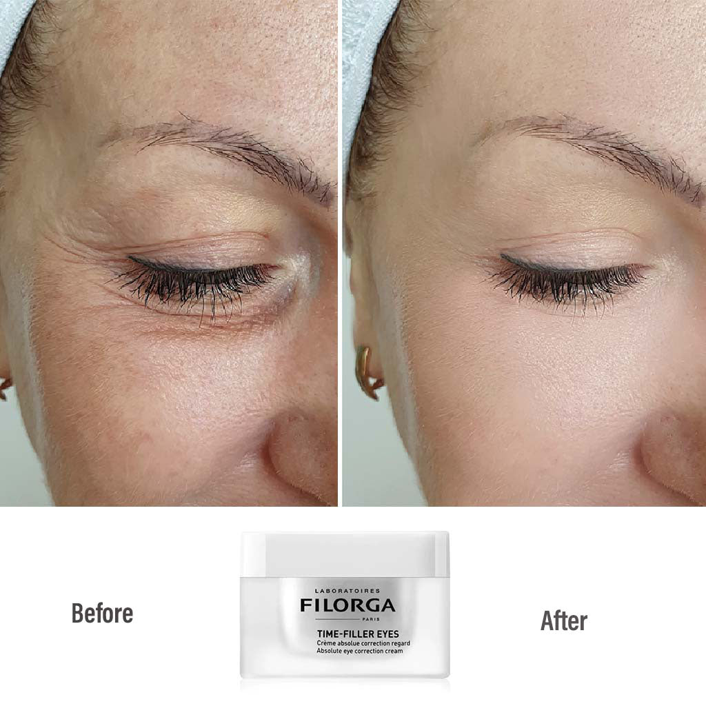 Filorga Time Filler Eyes 15 mL - Easy Pharmacy LLC
