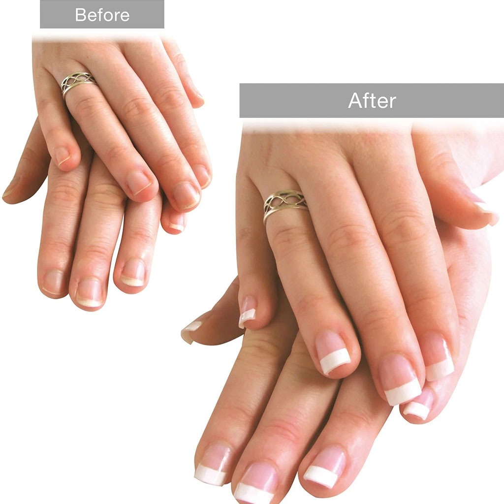 Rio 15W UV Lamp Nail Extension System - Easy Pharmacy LLC