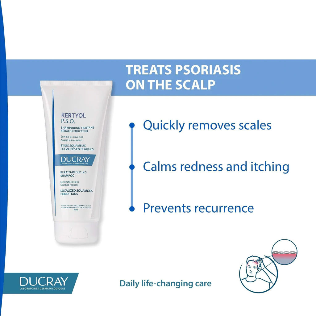 Ducray Kertyol P.S.O Shampoo 200 mL - Easy Pharmacy LLC