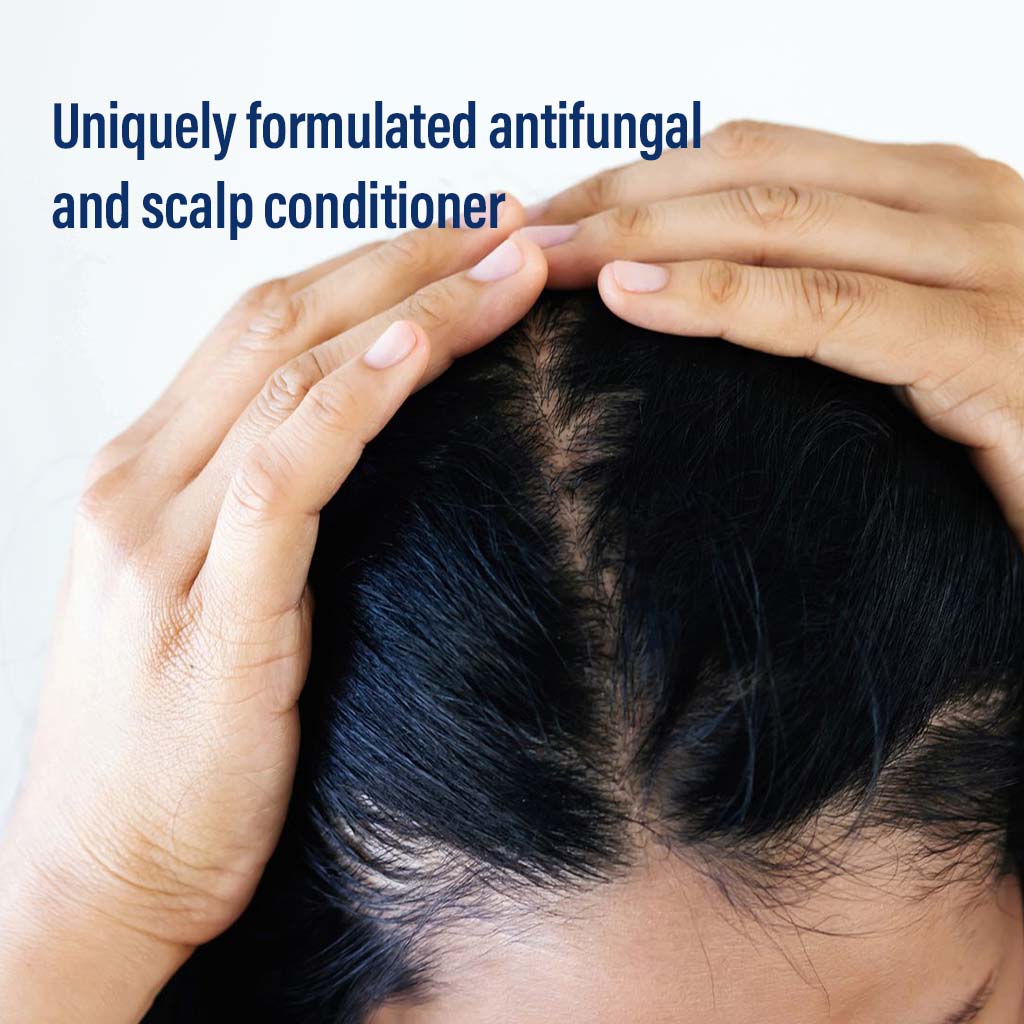 Skinlab Anti-Dandruff Conditioner Daily Care 250 mL - Easy Pharmacy LLC