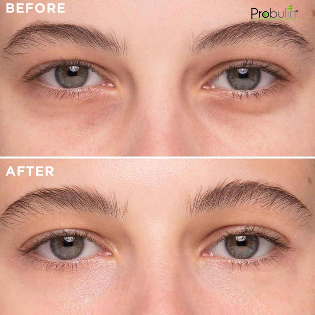 Probulin Probiotic Nourishing Marula Eye Cream Unscented For Tired & Puffy Eyes 29.9ml - Easy Pharmacy LLC
