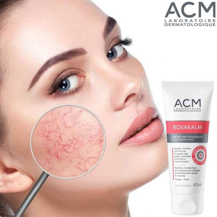 ACM Rosakalm Anti-Redness Cream For Reactive & Sensitive Skin 40ml - Easy Pharmacy LLC