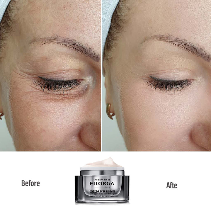 Filorga NCEF Reverse Eyes Cream 15 mL - Easy Pharmacy LLC