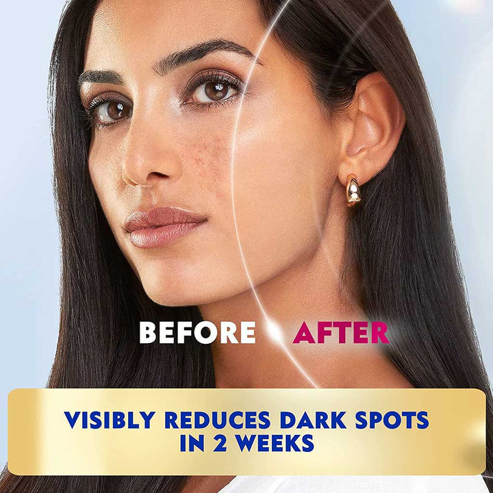 Nivea Luminous630 Even Glow Concentrated Serum 30 mL - Easy Pharmacy LLC