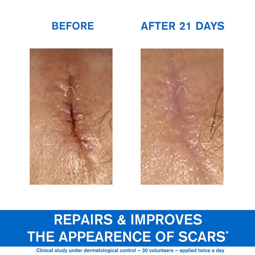 Uriage Bariederm-CICA Repairing Cream With Copper & Zinc 100ml - Easy Pharmacy LLC