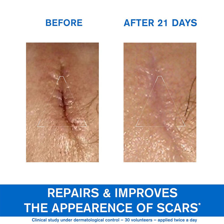 Uriage Bariederm-CICA Repairing Cream With Copper & Zinc 100ml - Easy Pharmacy LLC