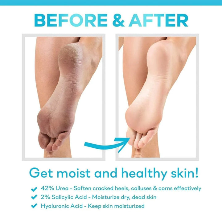 CeraVe SA Renewing Foot Cream With Salicylic Acid For Dry, Rough, Bumpy Skin 88ml - Easy Pharmacy LLC