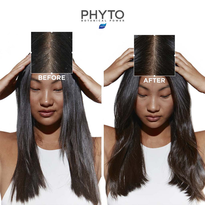 Phyto Phytosquam Phase 2 Anti-Dandruff Purifying Maintenance Shampoo For Dandruff & Oily Scalp 250ml - Easy Pharmacy LLC