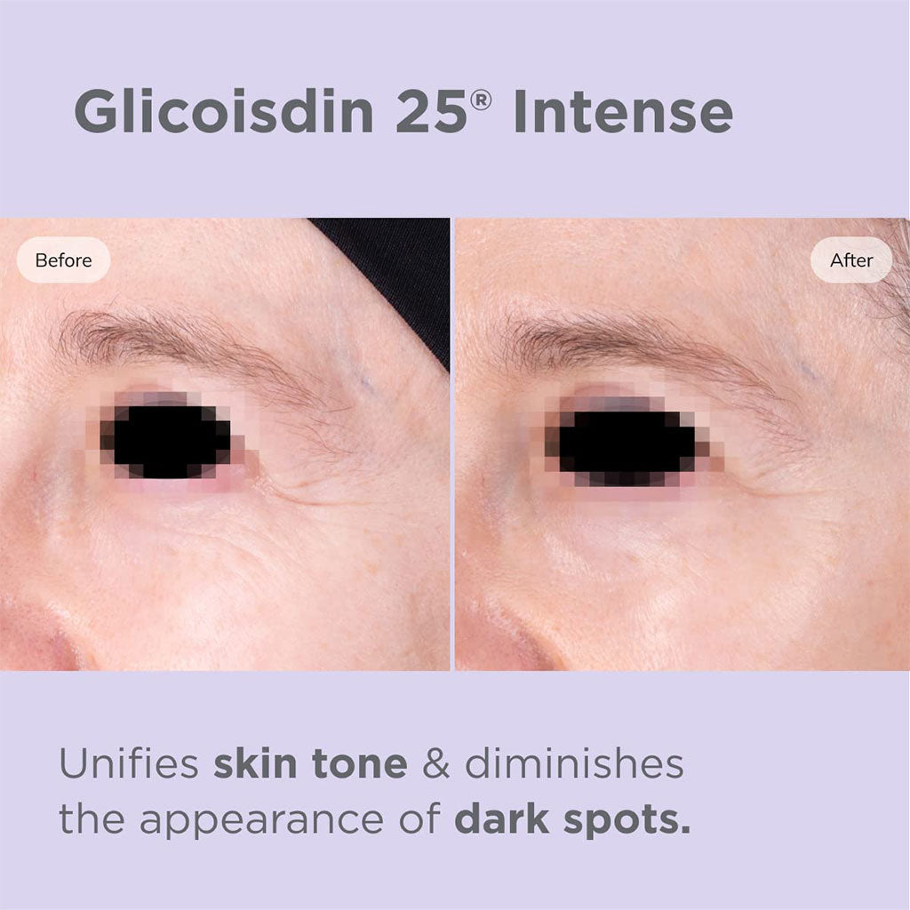 Isdin Isdinceutics Glicoisdin 25 Intense Facial Gel 50 g - Easy Pharmacy LLC
