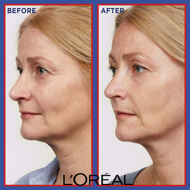 Loreal Paris Revitalift Laser Renew Triple Action Antiaging Facial Super Serum 30ml - Easy Pharmacy LLC