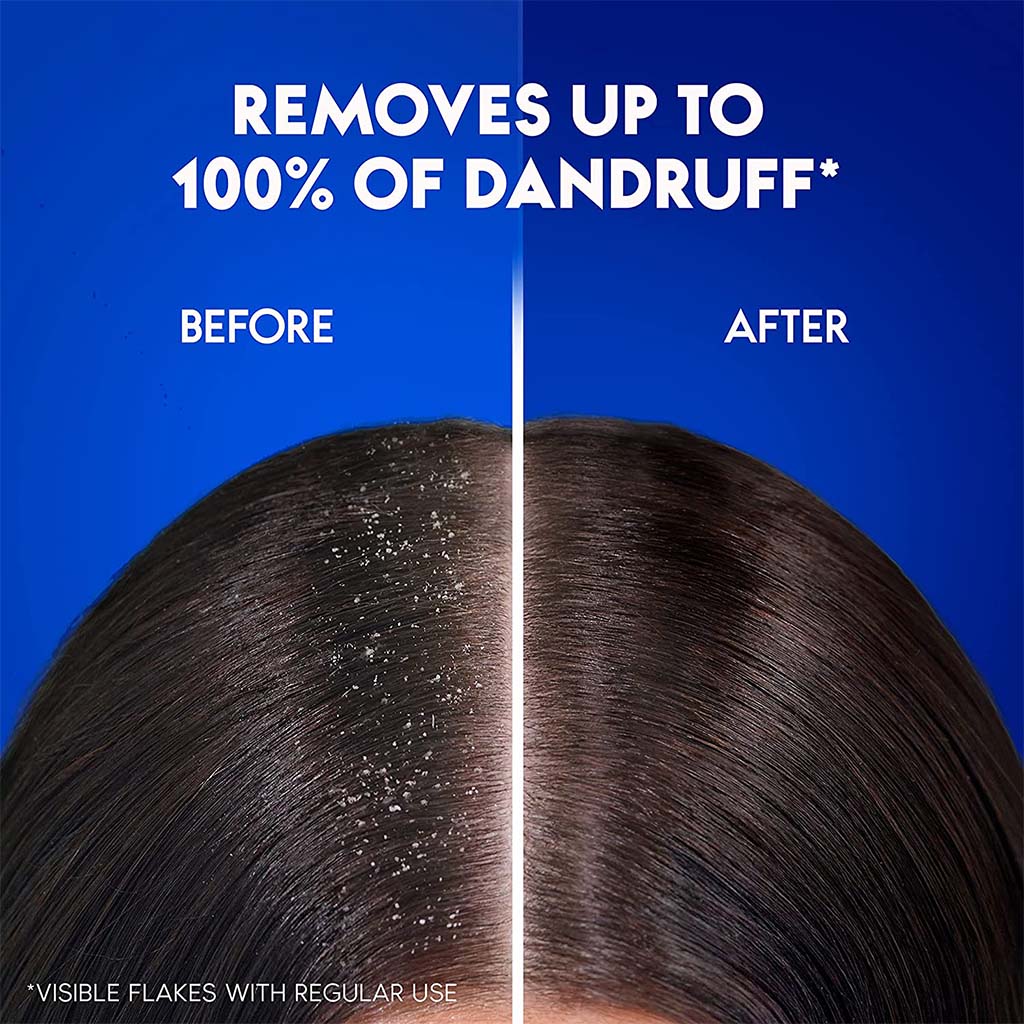 Head & Shoulders Hairfall Defense Anti-Dandruff Shampoo For Men 200ml - Easy Pharmacy LLC