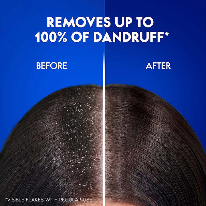 Head & Shoulders Hairfall Defense Anti-Dandruff Shampoo For Men 200ml - Easy Pharmacy LLC