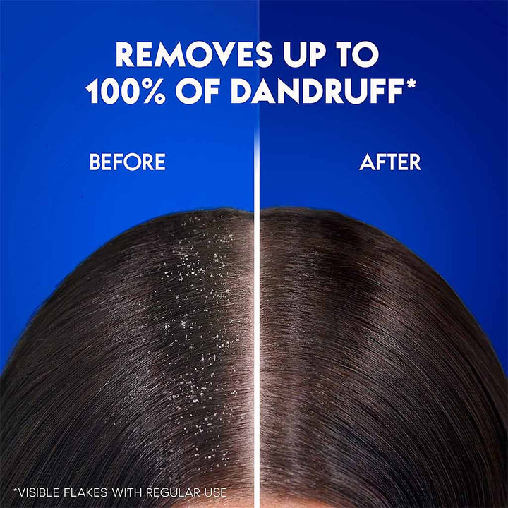 Head & Shoulders Dry Scalp Care Anti-Dandruff Paraben Free Shampoo With Almond Oil 400ml - Easy Pharmacy LLC