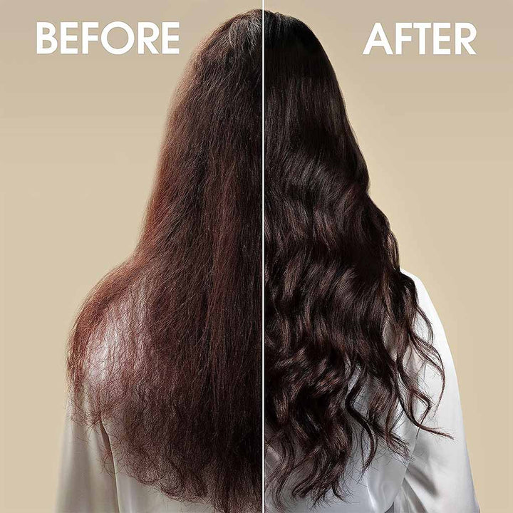 Head & Shoulders Supreme Scalp Soothing Anti-Dandruff Shampoo For Sensitive Scalp 400ml - Easy Pharmacy LLC
