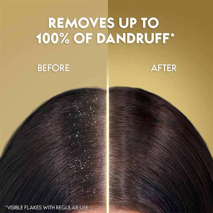 Head & Shoulders Supreme Anti-Dandruff Shampoo With Argan Oil For Dry Scalp Rejuvenation 400ml - Easy Pharmacy LLC