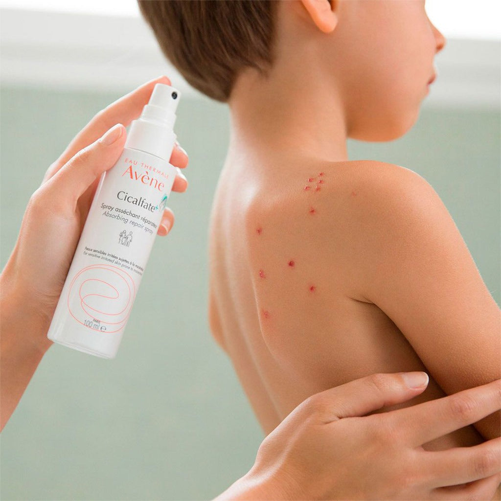 Avene Cicalfate+ Absorbing Repair Spray 100ml - Easy Pharmacy LLC