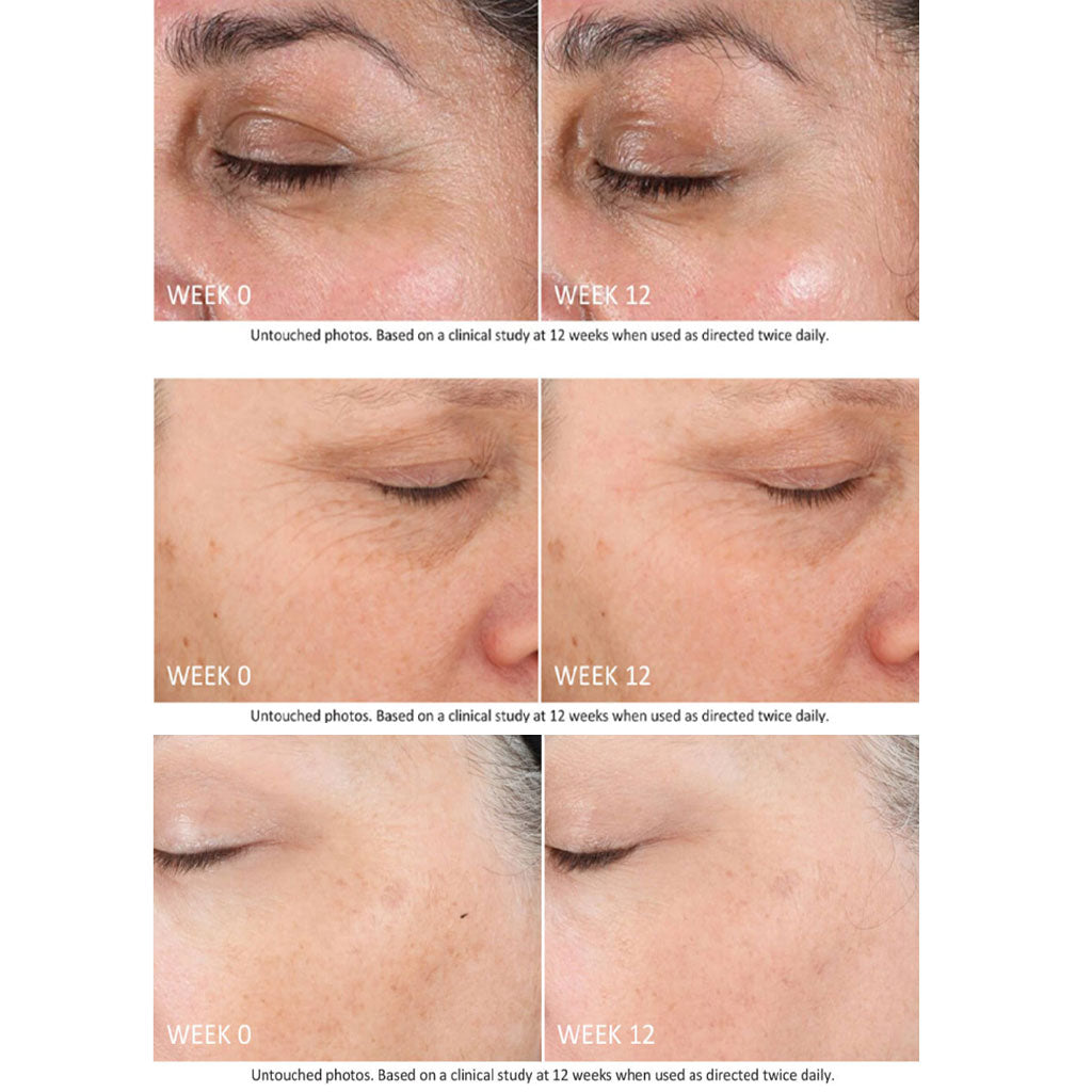 Neostrata Skin Active Firming Tri-Therapy Lifting 3D Volumizer Facial Serum 30ml - Easy Pharmacy LLC
