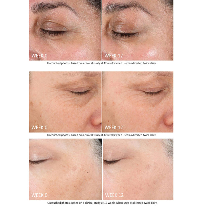 Neostrata Skin Active Firming Tri-Therapy Lifting 3D Volumizer Facial Serum 30ml - Easy Pharmacy LLC