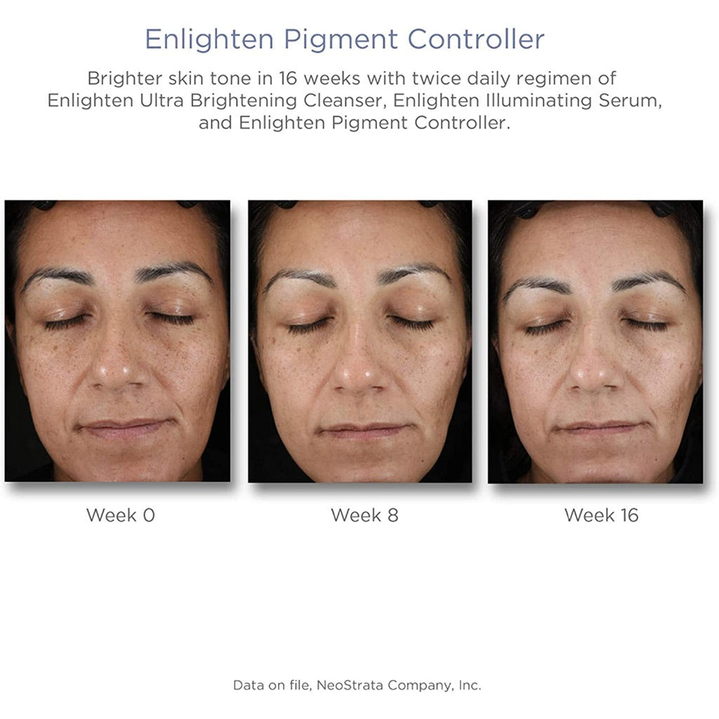 Neostrata Enlighten Pigment Controller Fluid For Dark spots and Uneven skin tone 50ml - Easy Pharmacy LLC