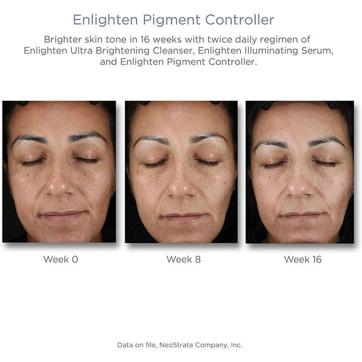 Neostrata Enlighten Pigment Controller Fluid For Dark spots and Uneven skin tone 50ml - Easy Pharmacy LLC