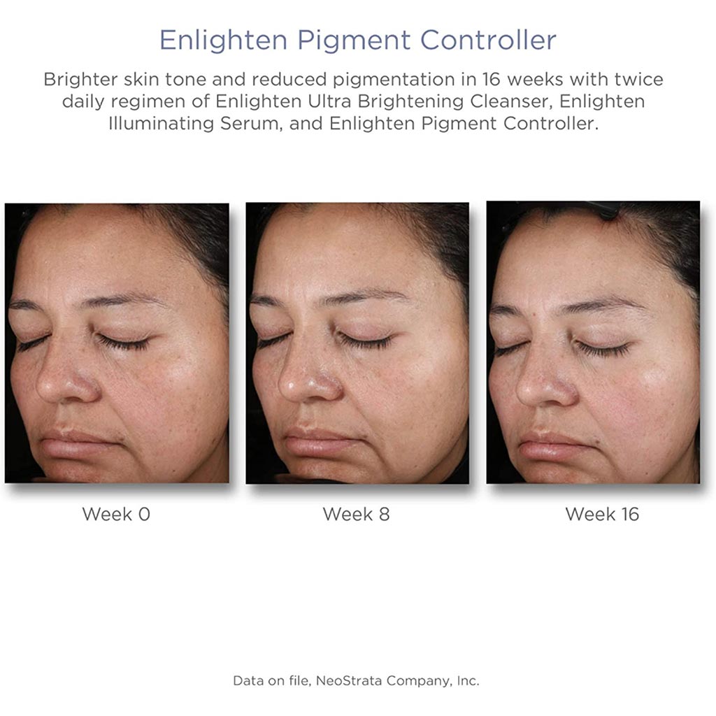 Neostrata Enlighten Pigment Controller Fluid For Dark spots and Uneven skin tone 50ml - Easy Pharmacy LLC