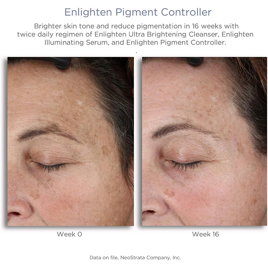 Neostrata Enlighten Pigment Controller Fluid For Dark spots and Uneven skin tone 50ml - Easy Pharmacy LLC