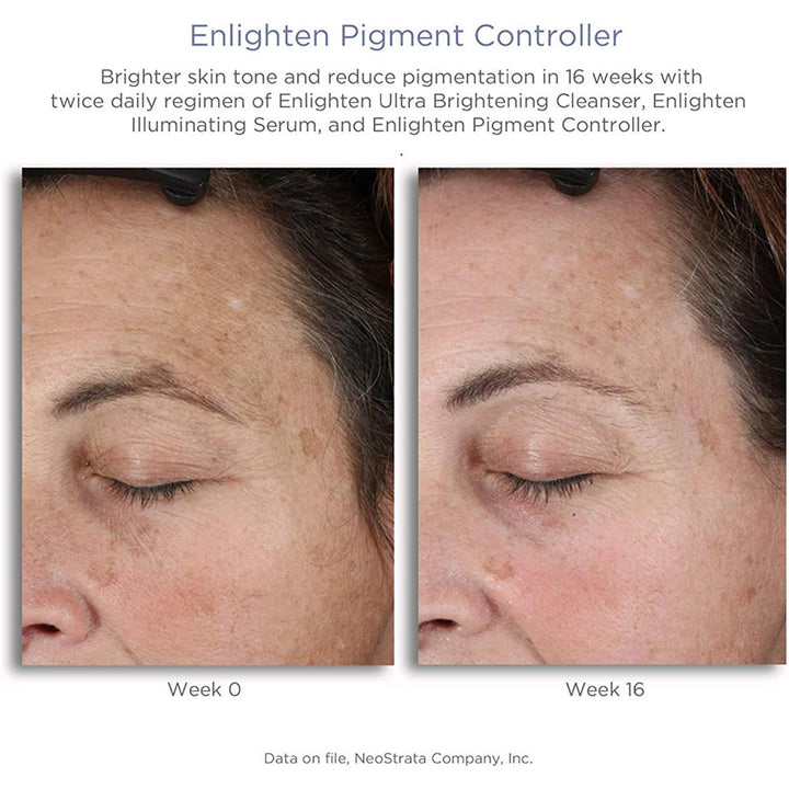 Neostrata Enlighten Pigment Controller Fluid For Dark spots and Uneven skin tone 50ml - Easy Pharmacy LLC