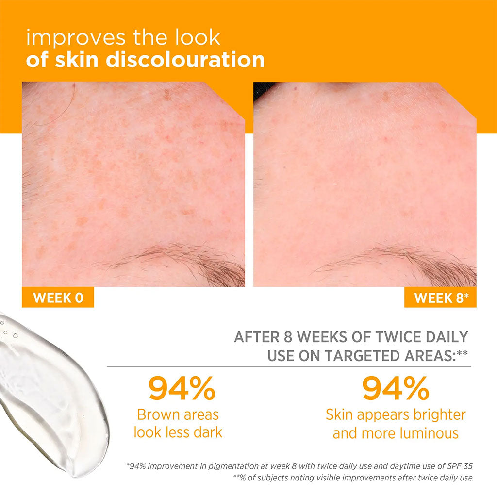 Neostrata Enlighten Pigment Lightening Gel For Dark spots and Uneven skin tone 40g - Easy Pharmacy LLC