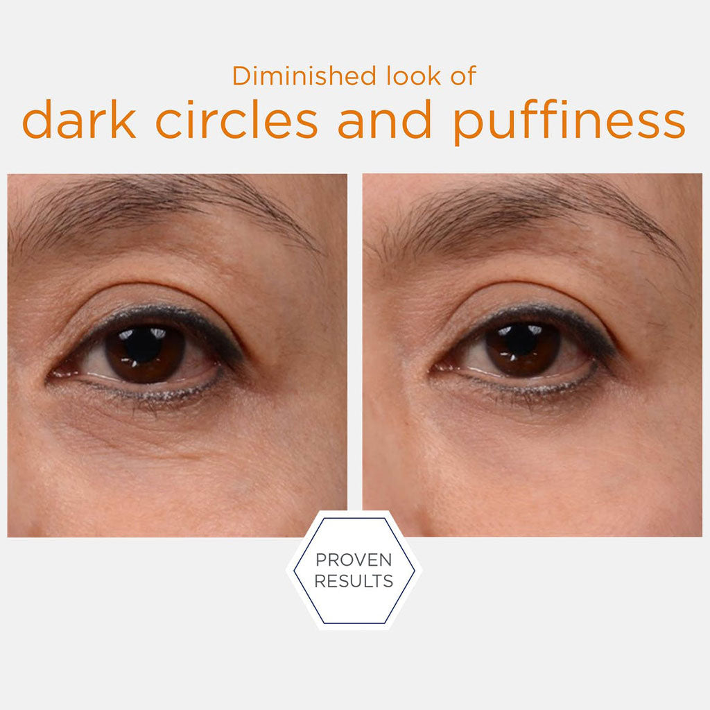 Neostrata Enlighten Brightening Eye Cream For Dark Circles, Wrinkles and Puffiness 15g - Easy Pharmacy LLC