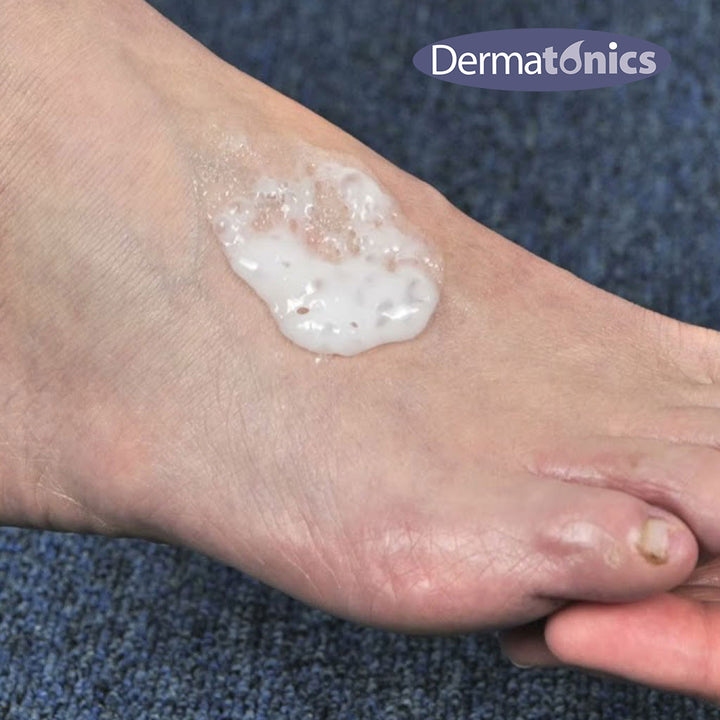 Dermatonics Deodorizing Fizzy Foot Foam With Manuka Honey And Menthol 150ml - Easy Pharmacy LLC