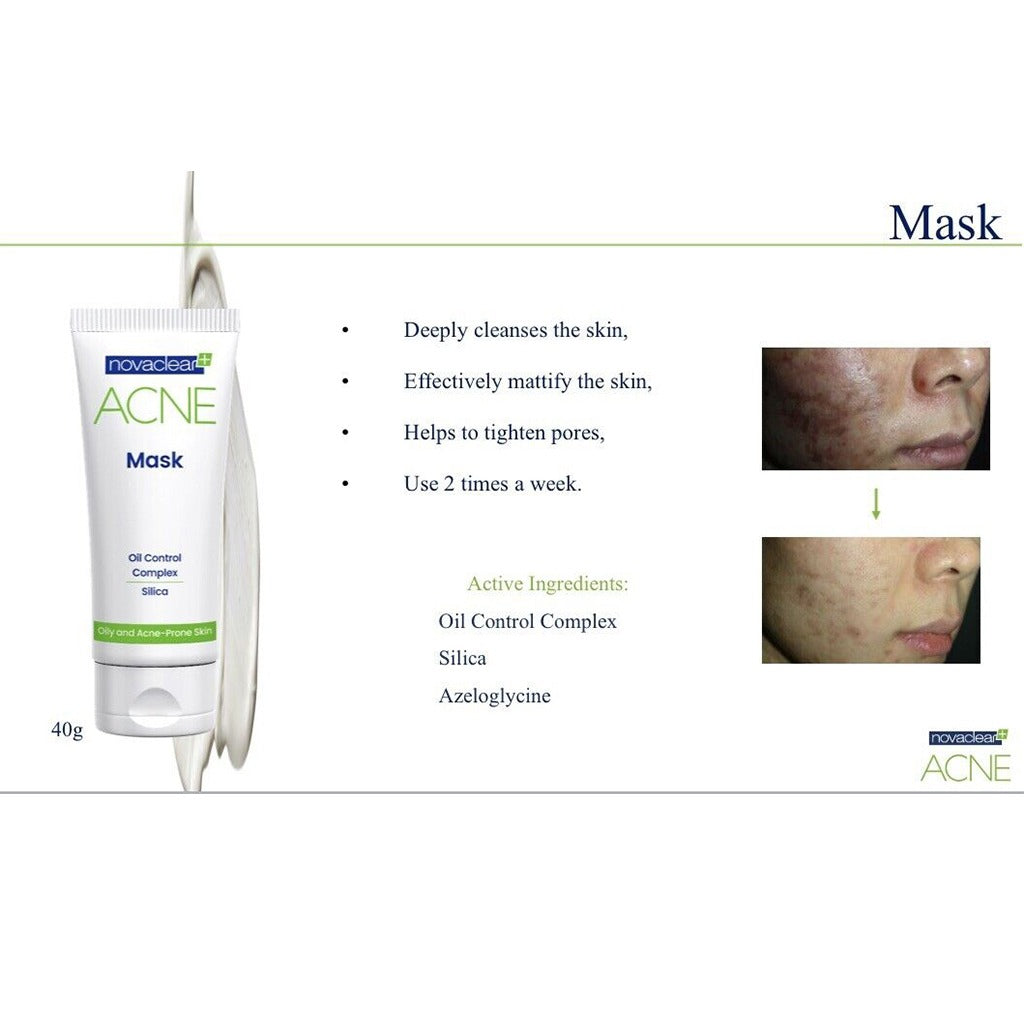 Novaclear Oil Control Mattifying Acne Mask For Oily, Acne-Prone and Combination Skin 40g - Easy Pharmacy LLC