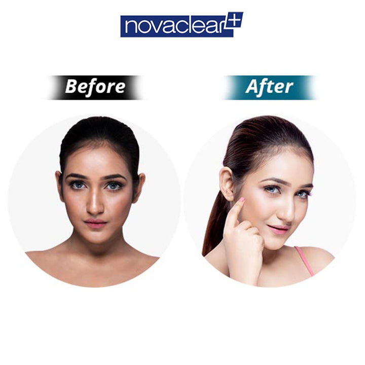 Novaclear Gluta White Plus Facial Night Cream For pigmentation and dark spots 50ml - Easy Pharmacy LLC