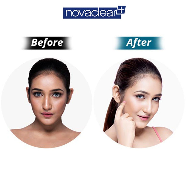 Novaclear Gluta White Plus Facial Night Serum For pigmentation and dark spots 30ml - Easy Pharmacy LLC