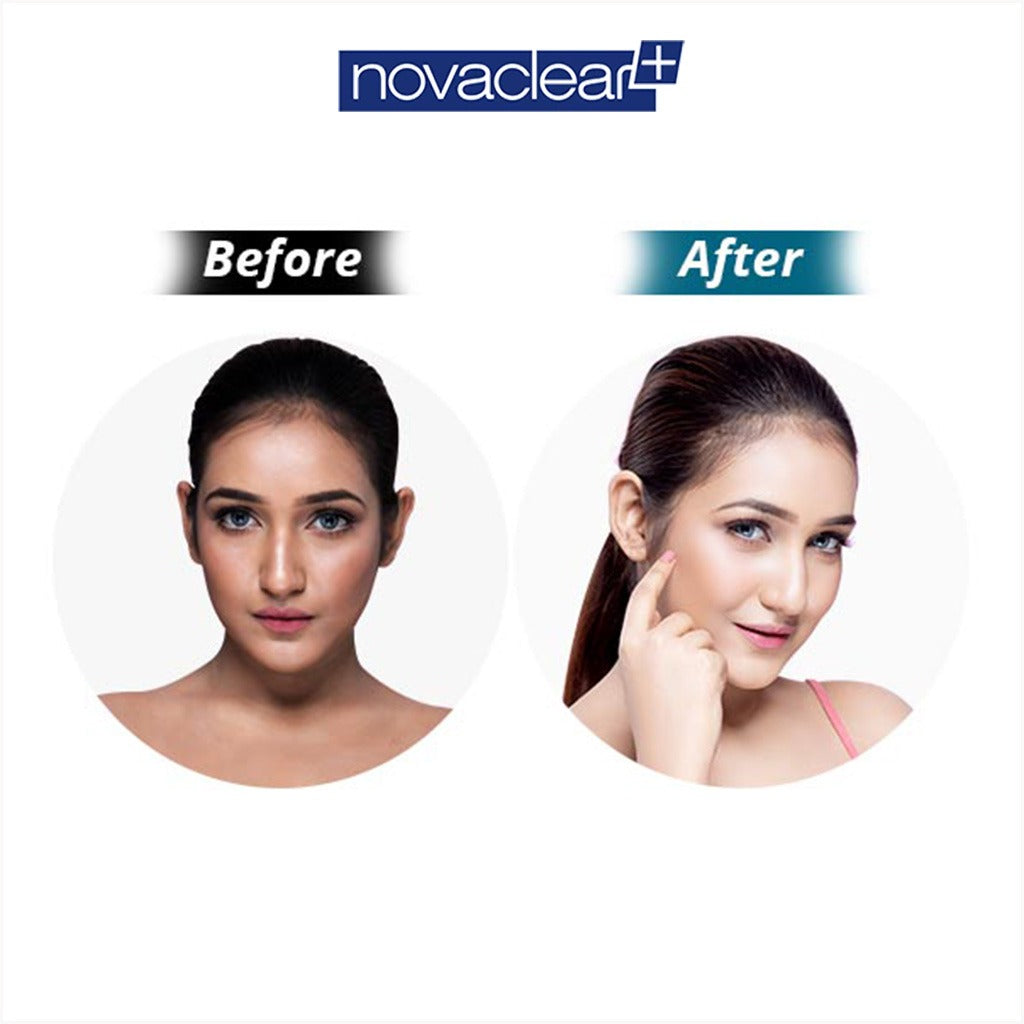 Novaclear Whitening Facial Brightening Day Cream with SPF50+, 50ml - Easy Pharmacy LLC