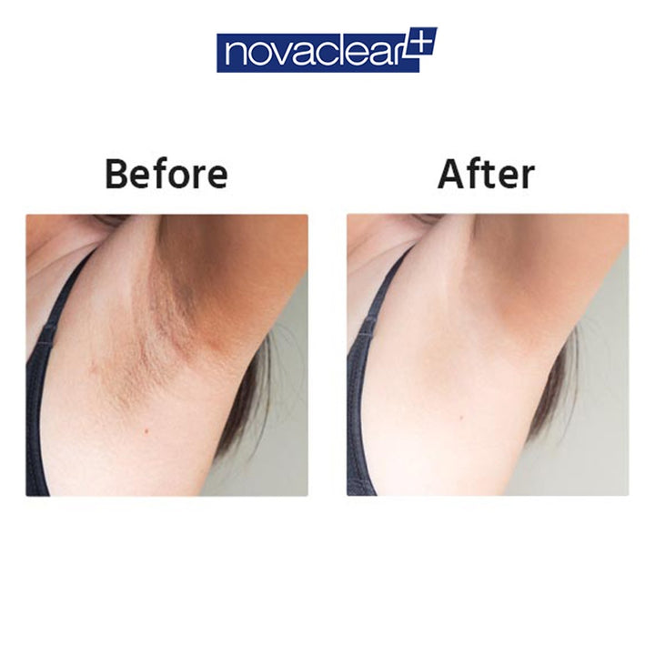 Novaclear Whitening Armpit Roll-On 50ml - Easy Pharmacy LLC
